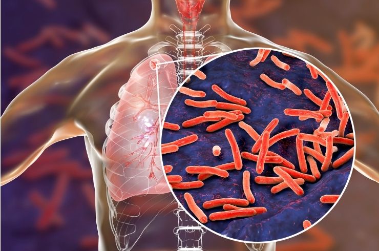 Respiratory Infections image